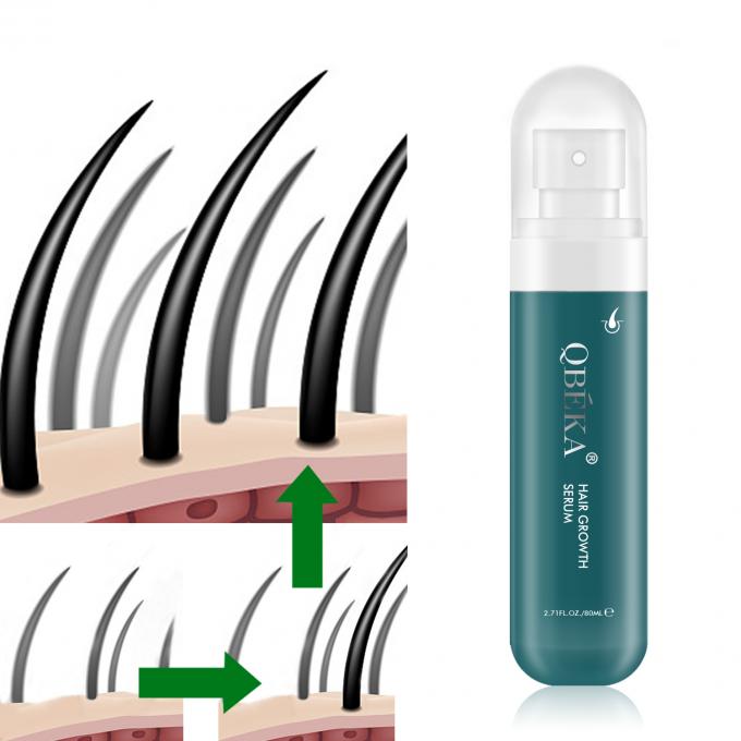 80ml ヘア成長オイル プライベート ラベル 製品 プロフェッショナル QC チーム 脱毛剤 0