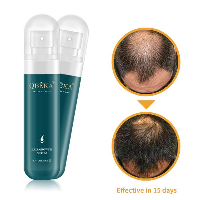 80ml ヘア成長オイル プライベート ラベル 製品 プロフェッショナル QC チーム 脱毛剤 1