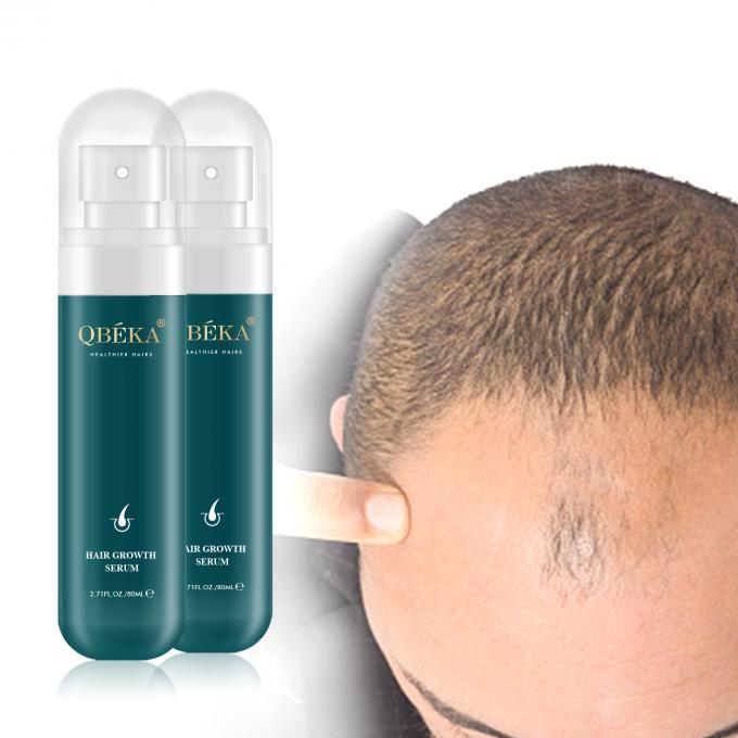 80ml ヘア成長オイル プライベート ラベル 製品 プロフェッショナル QC チーム 脱毛剤 2
