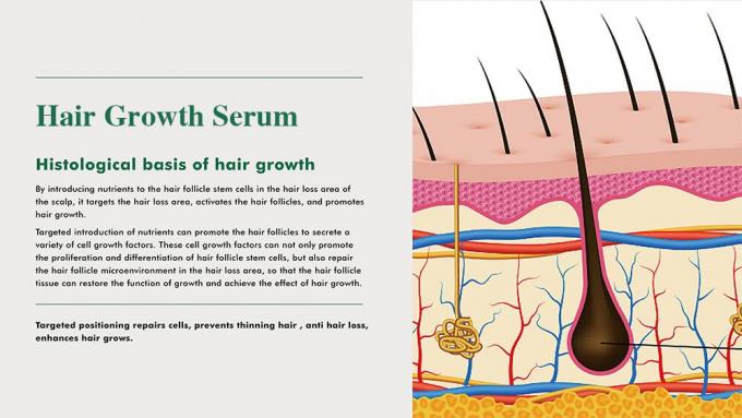 男性のためのハーブヘアトニク 脱毛を防ぐ 育毛を回復する 増強量 3ヶ月供給 0