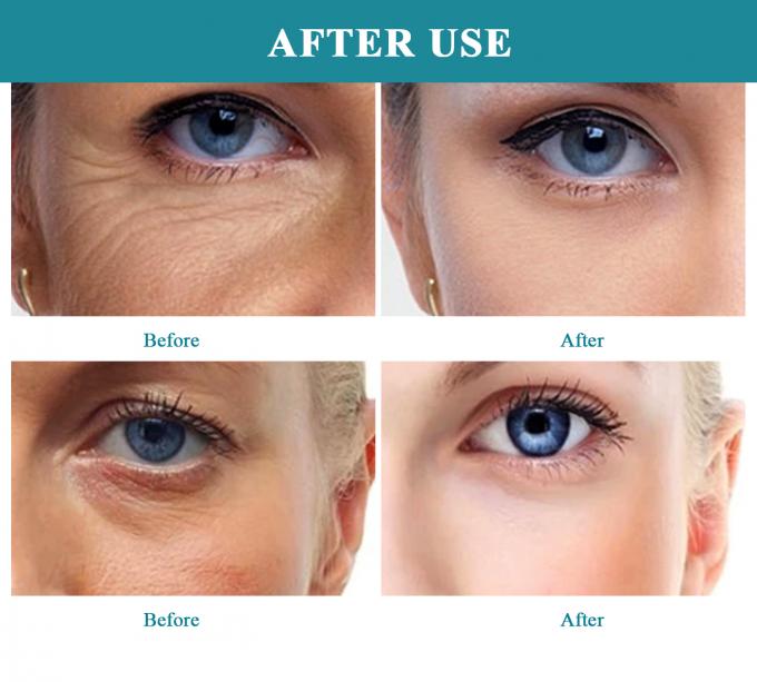 EYE 30ml ライトニング ヒアルロン酸 多効性 抗老化 皮膚ケア 近く 6